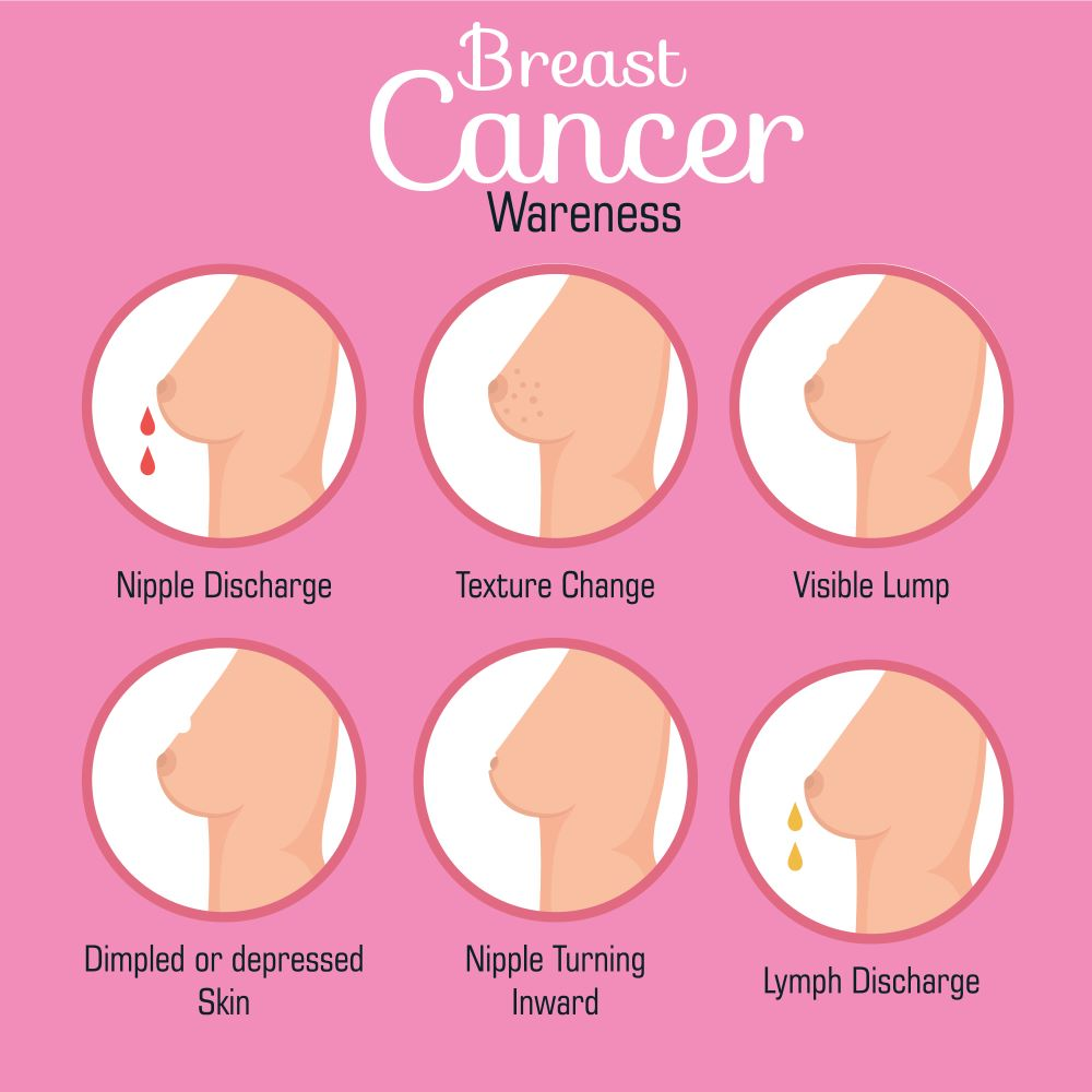 Breast cancer symptoms
