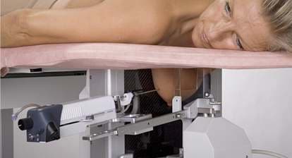 3D Stereotactic Biopsy Technology