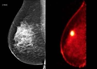 PET-CT Guided Biopsy Technology