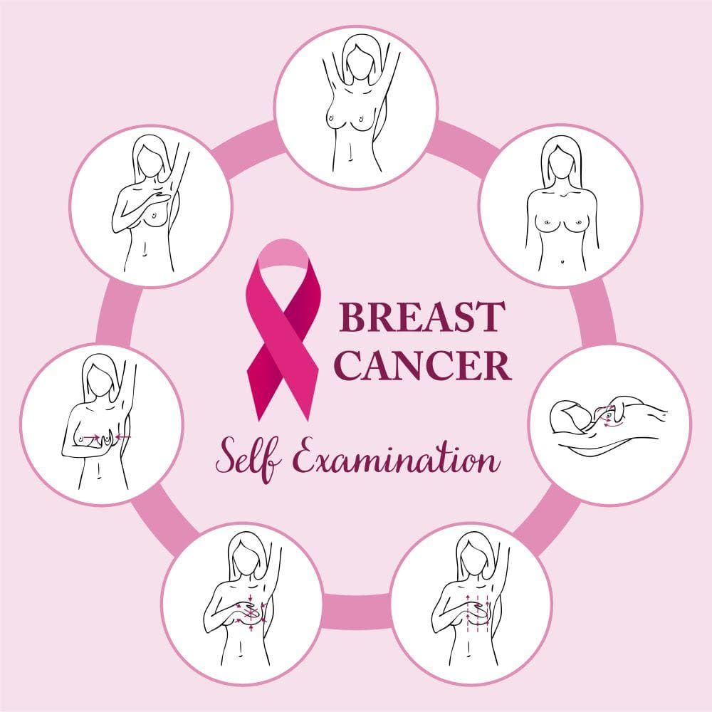 Promoting monthly self-examinations