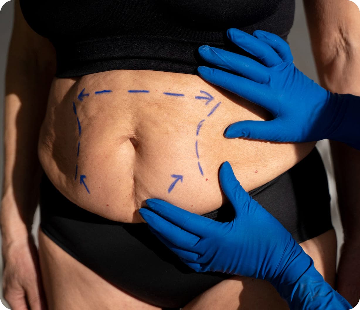 Surgical Treatments