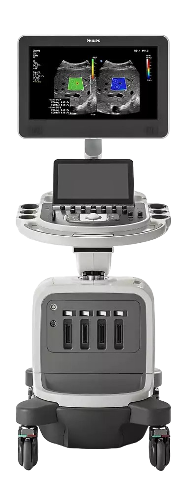 Breast Ultrasound & Doppler: