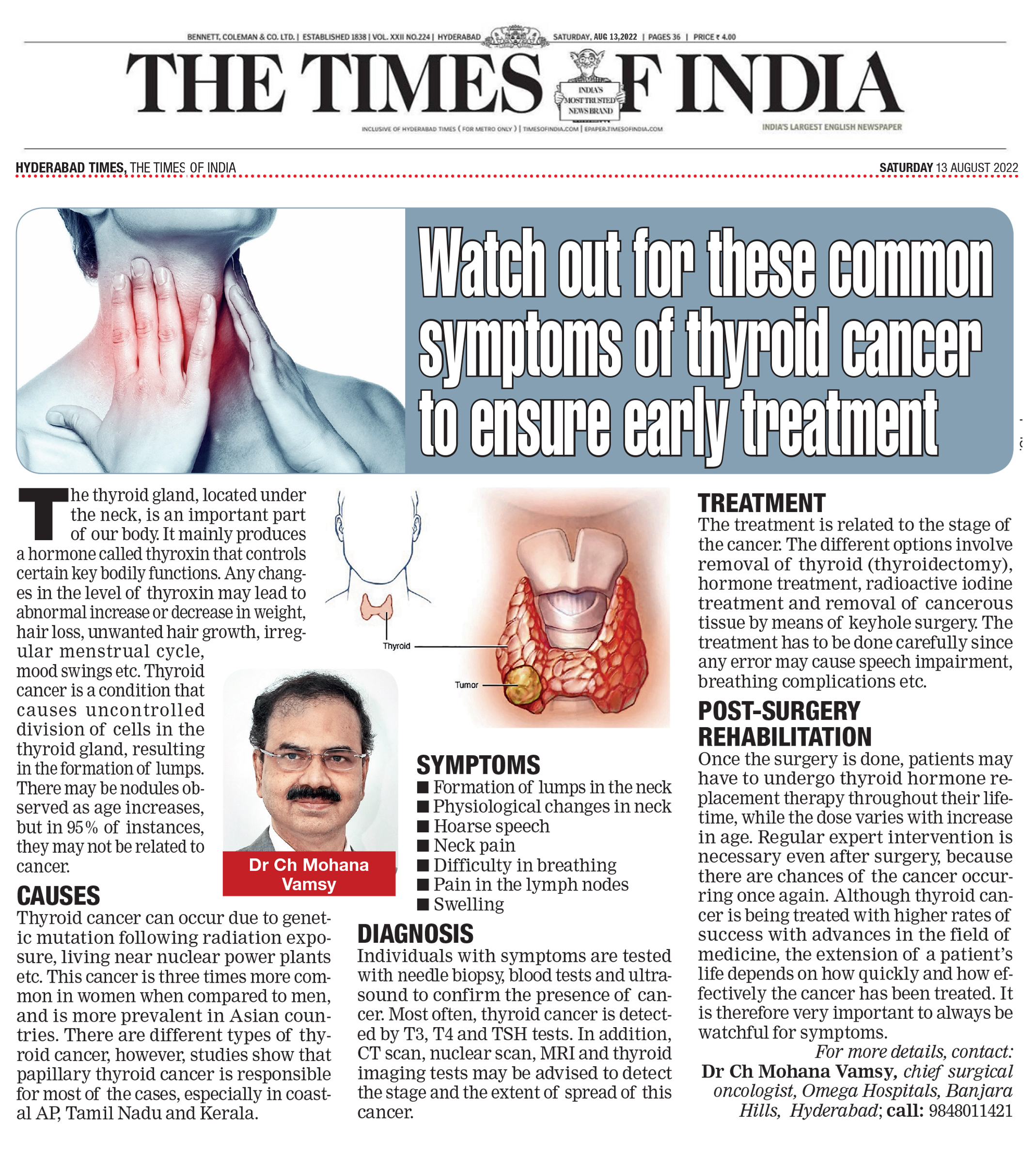 Watch out for these common symptoms of thyroid cancer to ensure early treatment 