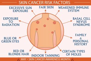 Skin cancer risk factors
