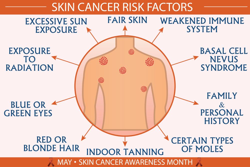 The Ultimate Guide to Skin Cancer: Protect Your Skin