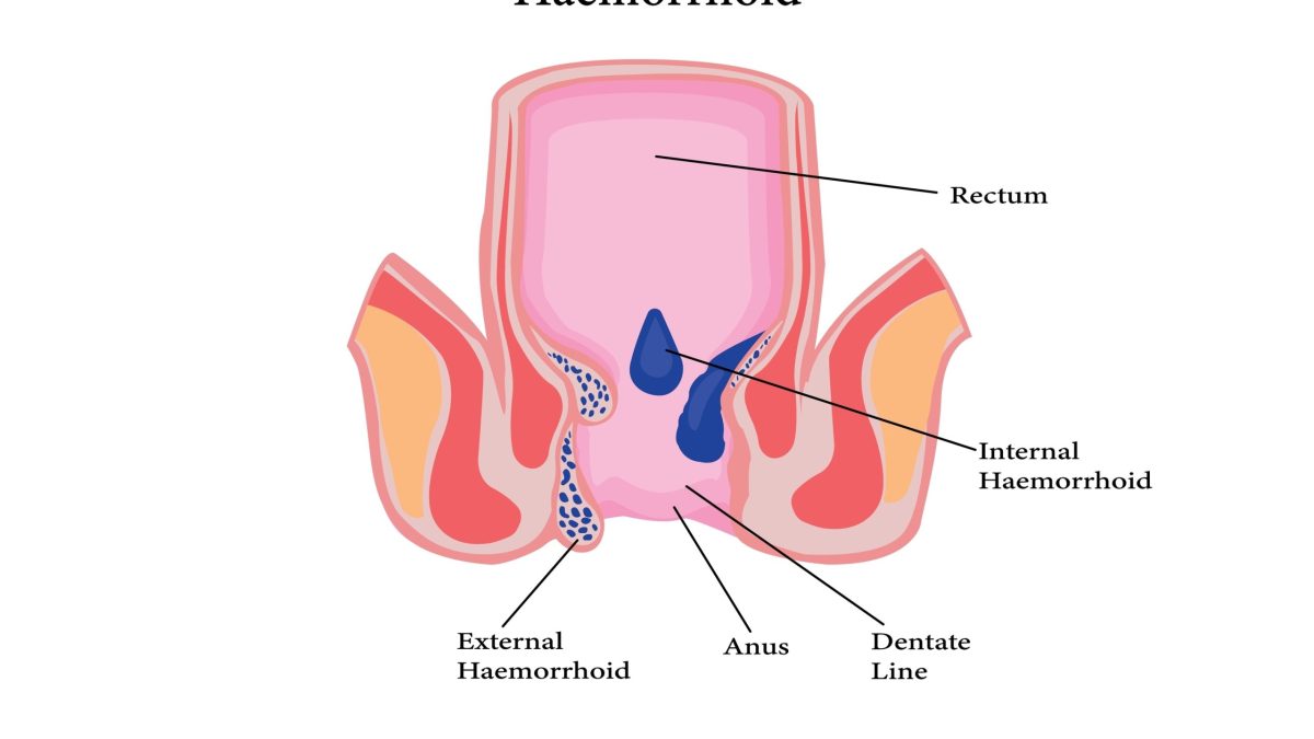 Human Anus Stretch