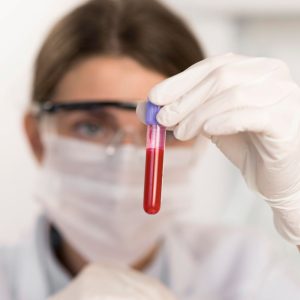 Healthcare workers exposed to blood