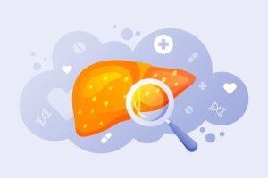 Hepatitis C Treatment