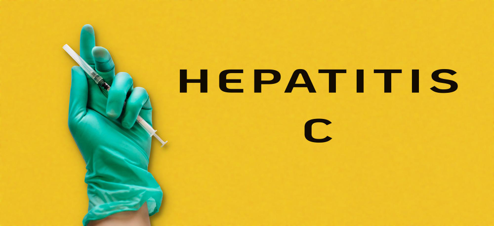 Hepatitis C