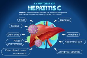 Hepatitis C Symptoms