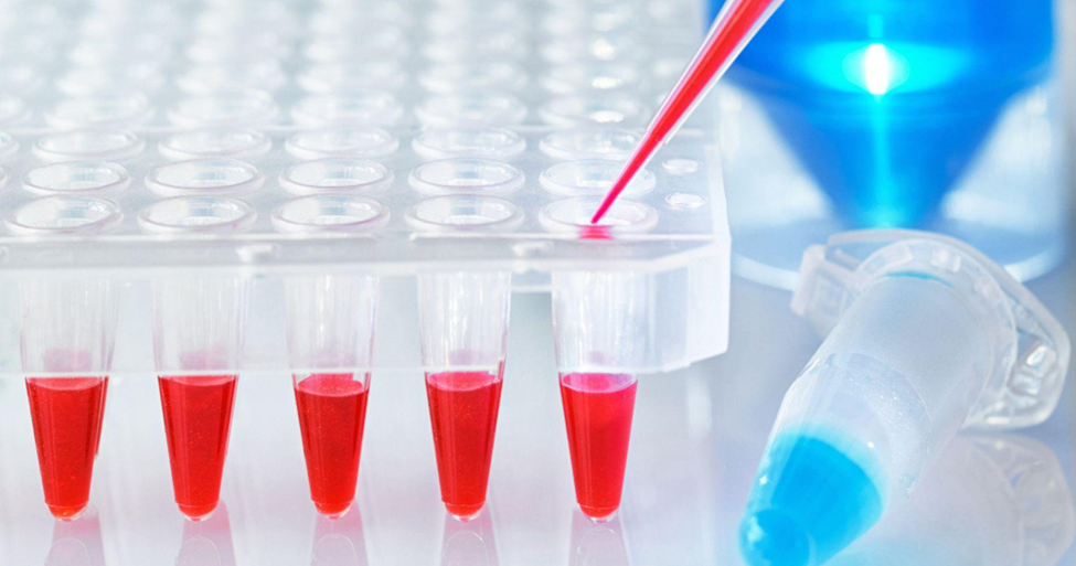 PCR (polymerase chain reaction) test