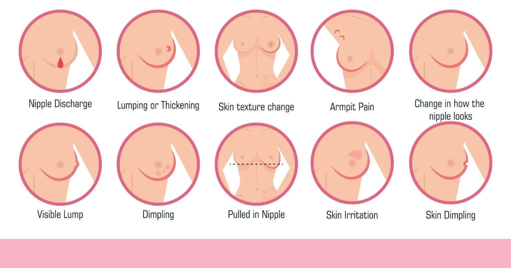 Early Signs of Breast Cancer You Should Never Ignore - Omega Hospitals1