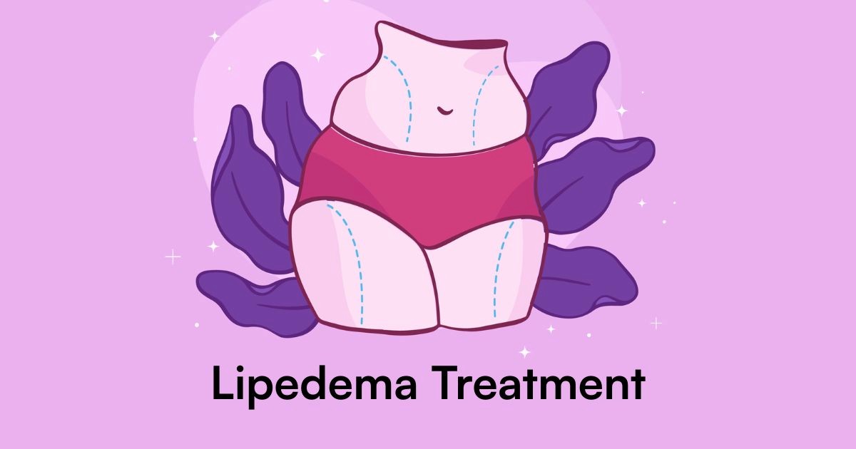 Lipedema Treatment Options: Surgery, Compression & Beyond