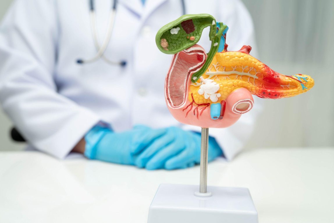 Pancreatic cancer