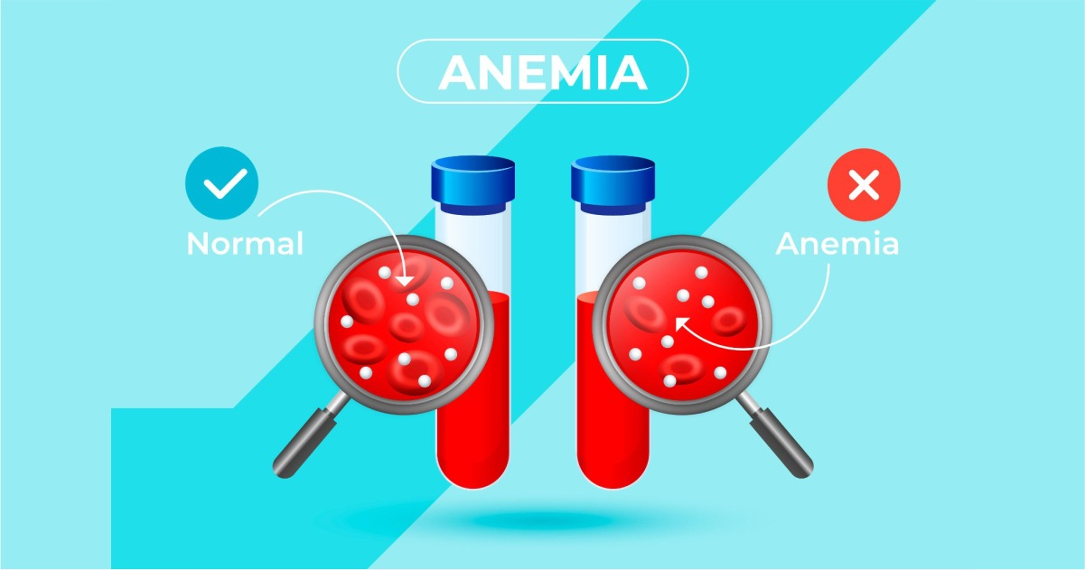 Why Anaemia Is Extremely Common in Indian Women